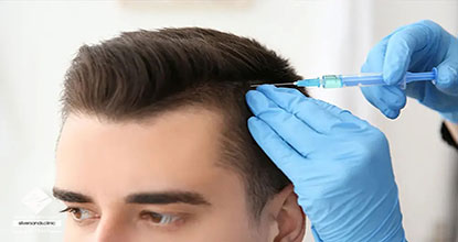 چگونه بهترین کلینیک کاشت مو در تهران را انتخاب کنیم