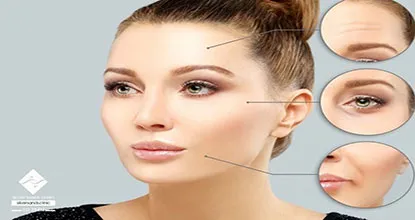 بعد از بوتاکس شقیقه چه نکاتی را رعایت کنیم