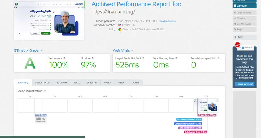 بعد از بهینه‌سازی